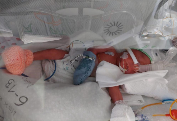 Felix in seinen ersten Lebenswochen auf der neonatologischen Station in einem Inkubator.

Foto: Anne Heinzig privat.
